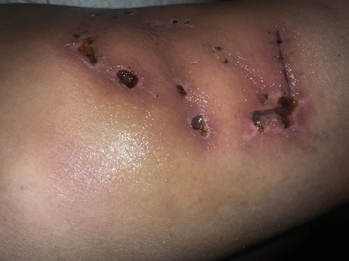 Client Photo